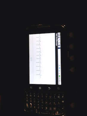 第一個發明手機兼容的心電圖測試的女生竟然沒有一部智能手機