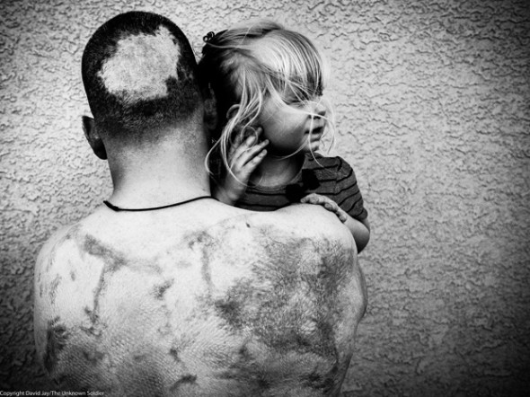 傷兵寂寂無名的生命寫照