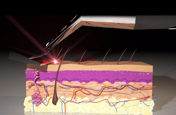 人人爭住買！Skarp 激光剃鬚／毛刀無痛免灼傷不刺激皮膚