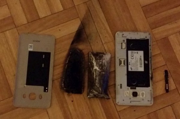 電話又爆炸！Samsung Galaxy J5 發生爆炸險炸斷小童雙手