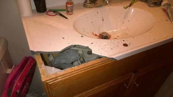 美國男子食電子煙突然發生爆炸！威力強大炸甩 7 隻牙及二級燒傷