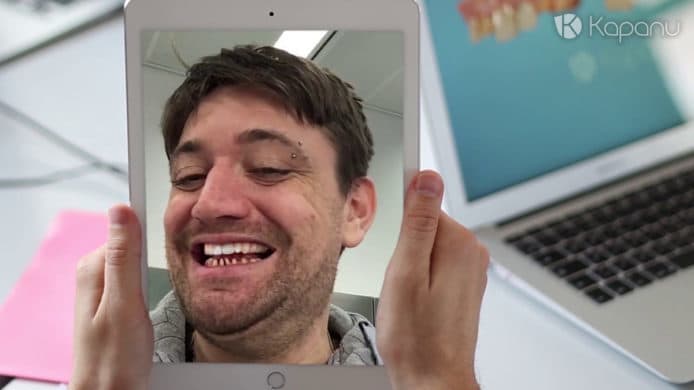 牙醫將來利用AR擴張現實　讓患者預視補牙箍牙後的效果