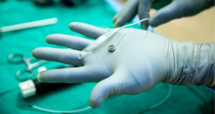 Neuralink 競爭對手 Paradromics 完成首次人體腦植入測試