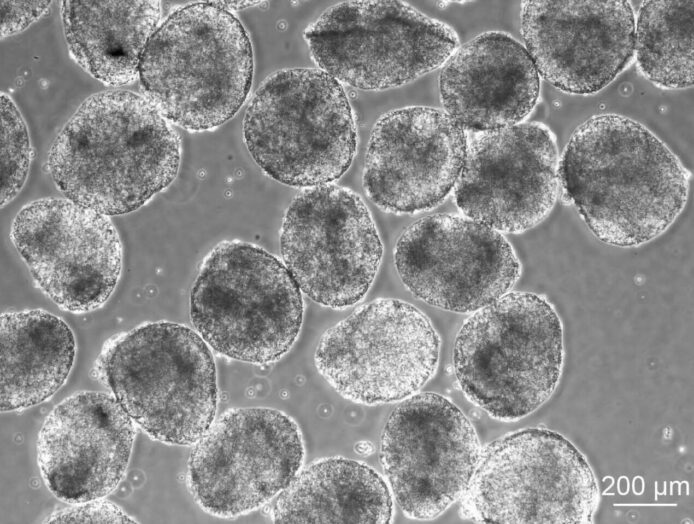日本正式批准 iPS 細胞療法　重新編程成人細胞治柏金遜症